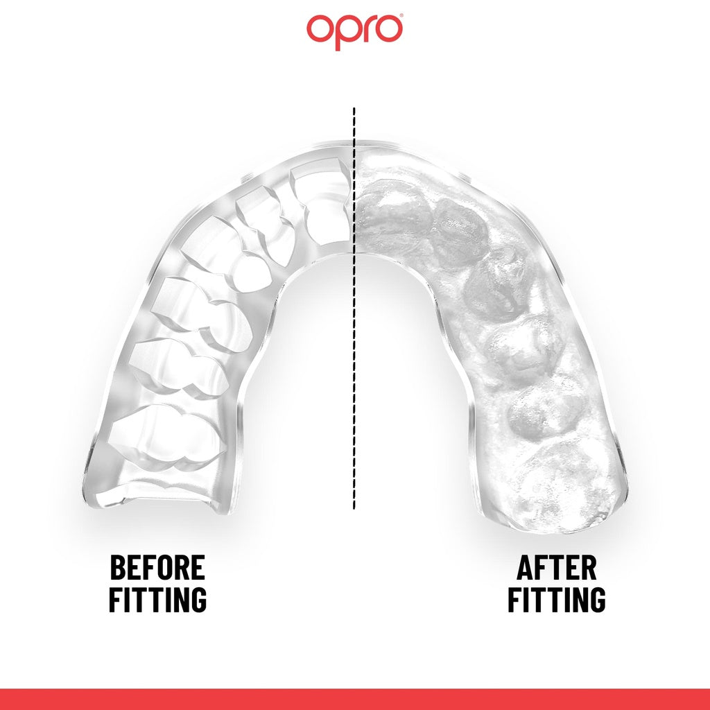 OPRO Instant Custom-Fit Mouthguard